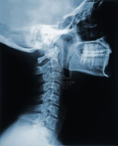 xray
